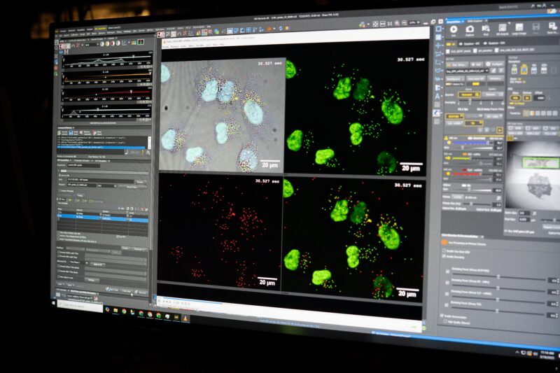A computer program displays four images taken from the lab microscopes. The images show larger, irregular structures that represent cells, while scattered around and inside the cells are smaller dots that show the LNPs interacting with the individual cells.